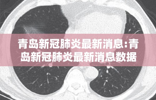 青岛新冠肺炎最新消息:青岛新冠肺炎最新消息数据